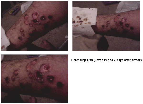 May Day Wounds (17 d...