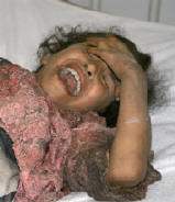 Strage degli innocen...