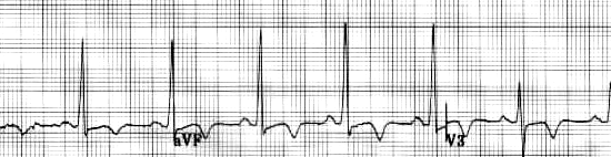 Signals From the Med...