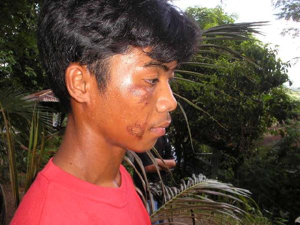 face injury...